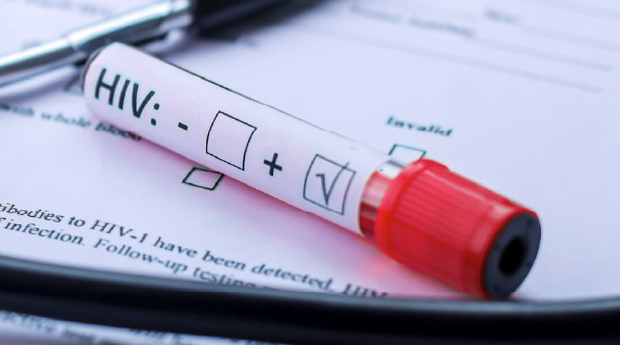 VIH sin miedo: Lo que tienes que saber sobre novedades en tratamiento y medicación.